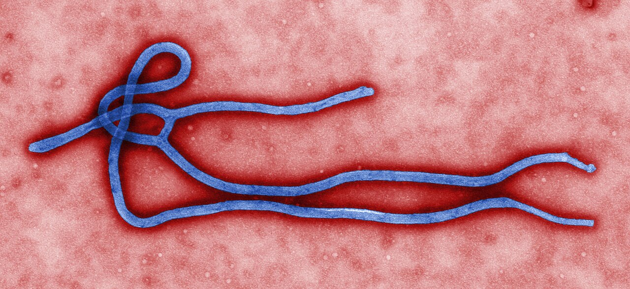 An Ebola virus particle seen under an electron microscope, in a colorized image from the U.S. Centers for Disease Control and Prevention (file photo).
